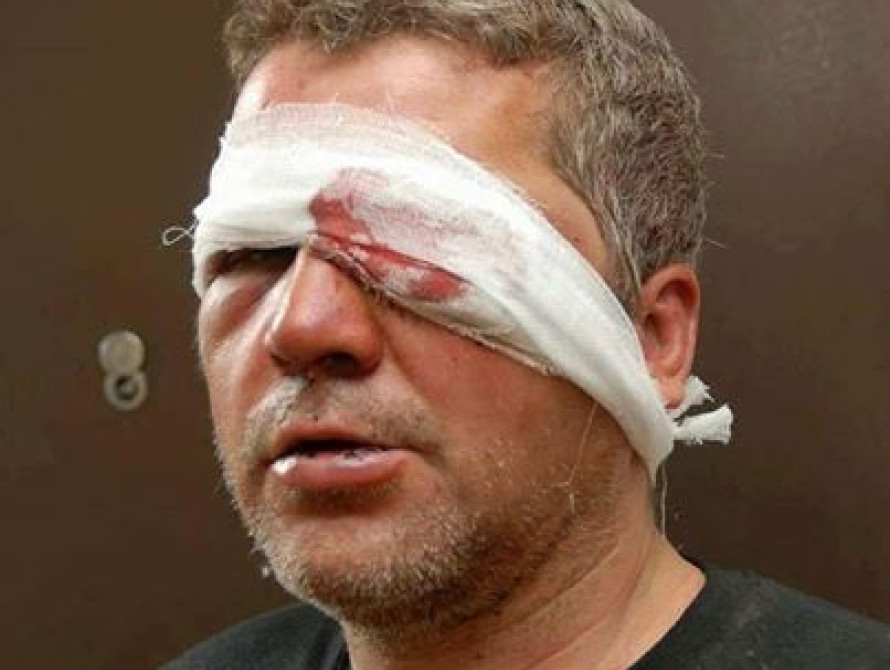 В Запорожье на Автовокзале был побит боец АТО, участник акции против облпрокурора 