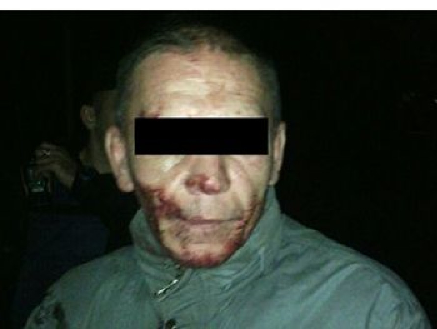 В Запорожье полицейские приехали на вызов в дом, где мужчина пил кровь собаки