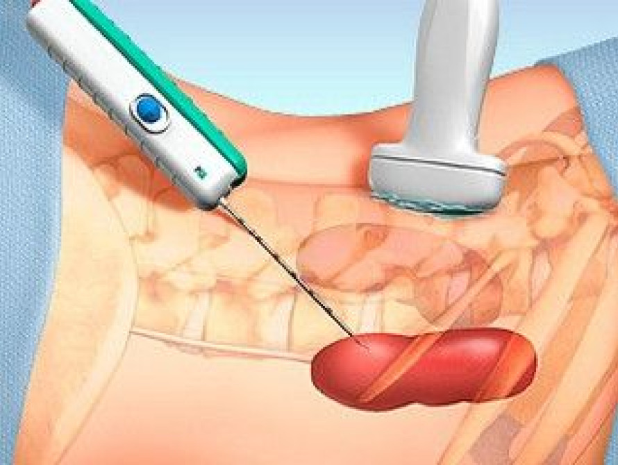 Запорожцам рассказали, как почки страдают от гриппа, ОРВИ и ангины