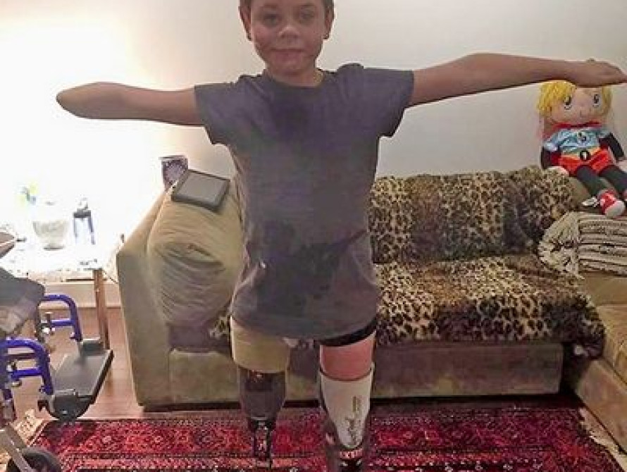 В Запорожье 12-летний мальчик, который подорвался на мине в АТО, отжался в поддержку ветеранов (видео)