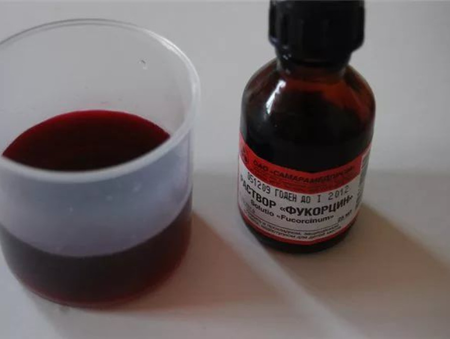 Под Запорожьем женщина мстила одноклассникам своего сына