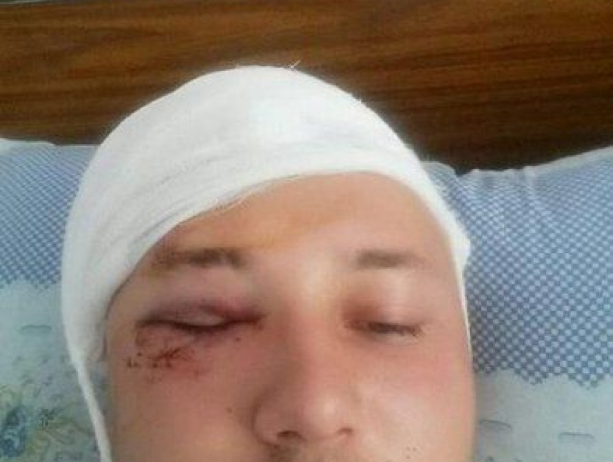 В Запорожье уволили патрульного полицейского, которого избили этим летом