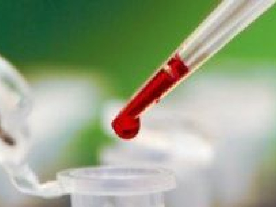 В Запорожье ищут доноров крови для мужчины, находящегося в коме 