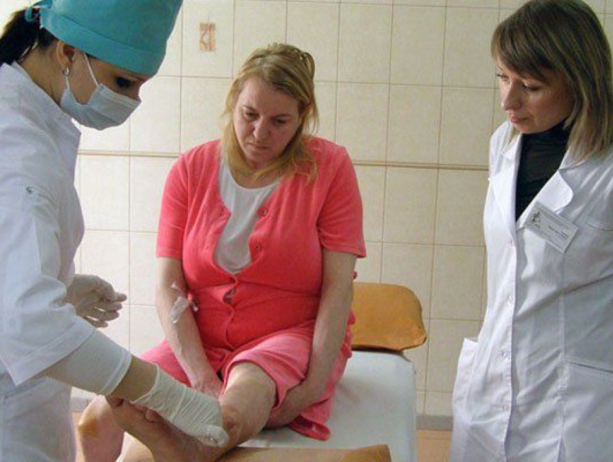 В Запорожье неизвестный облил девушку кислотой