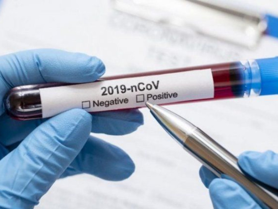 В Запорожской области 22 новых случая COVID-19 и еще один умерший от коронавируса