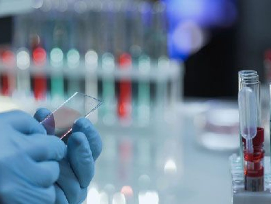 В Украине очередной антирекорд по COVID-19: +1847 новых случаев за сутки