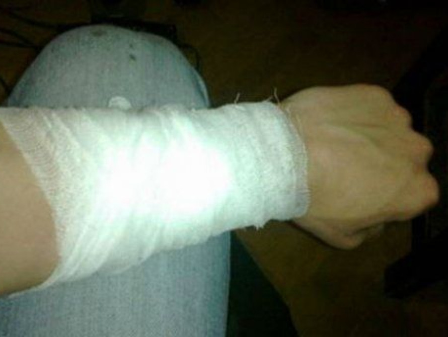 В Запорожской области парень порезал себе вены: его госпитализировали