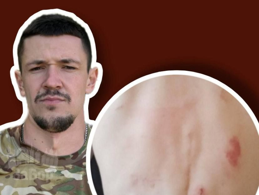 Іван Бабушкін, на якого напали у Києві