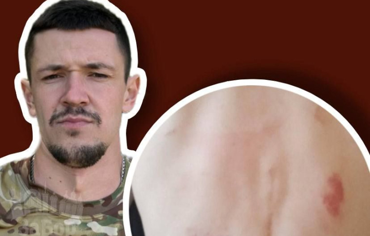 Жорстоко побили звільненого з полону військового, який відкрив ветеранську кав’ярню у Запоріжжі (фото, відео)