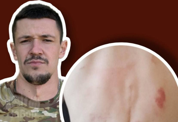 Жорстоко побили звільненого з полону військового, який відкрив ветеранську кав’ярню у Запоріжжі (фото, відео)