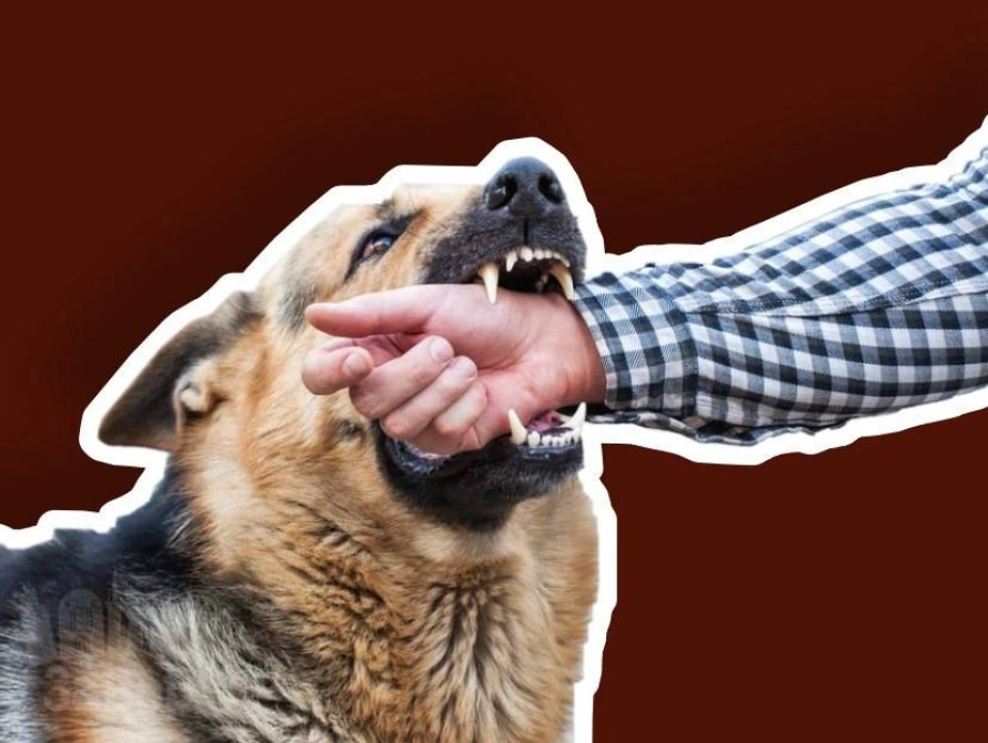 28 запоріжців звернулися до лікарів через укуси тварин