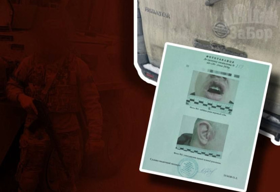 Боєць із Запорізького напрямку заявляє про викрадення: у Дніпрі ветерана побили та викинули на АЗС (фото)