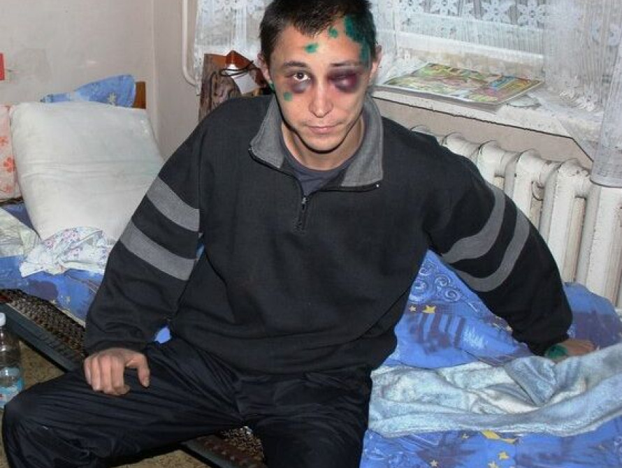 В Запорожье избили журналиста, пострадавший в тяжелом состоянии