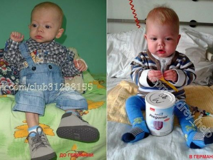 Ребенка из Запорожья спасают в Германии