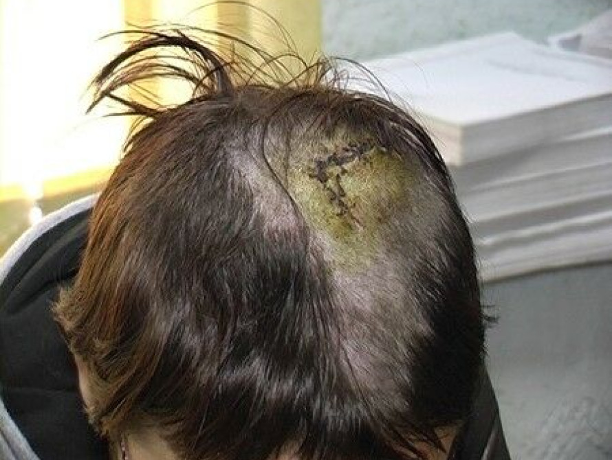 В Мелитополе грабитель с ножом украл волосы для магического обряда