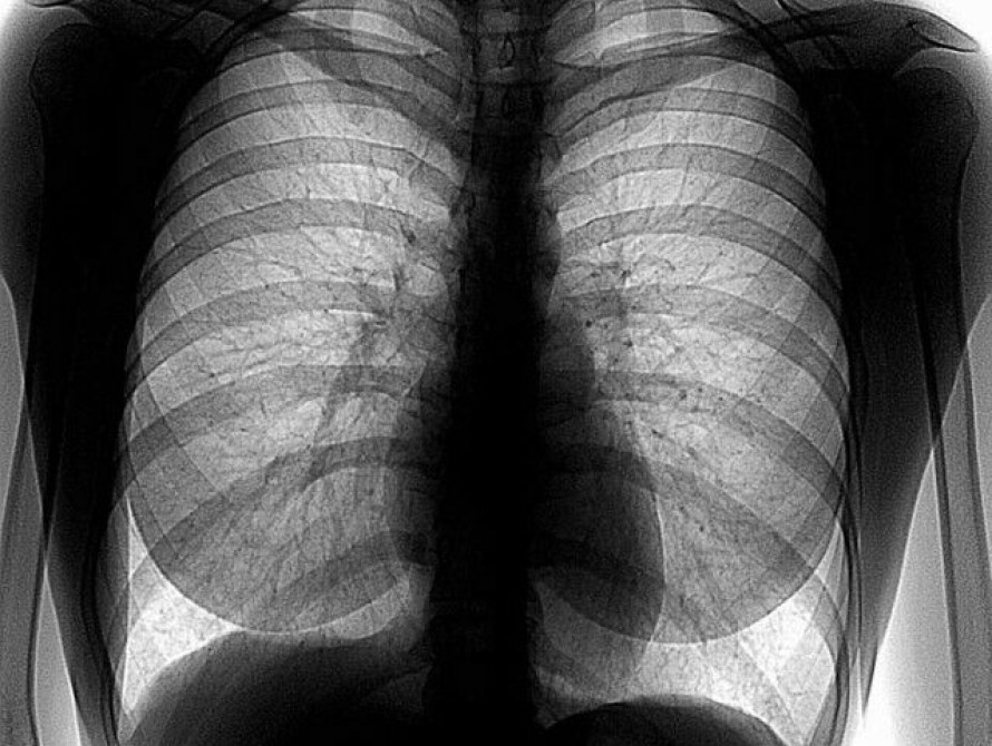 В Запорожье епархия предлагает бесплатно пройти флюорографию