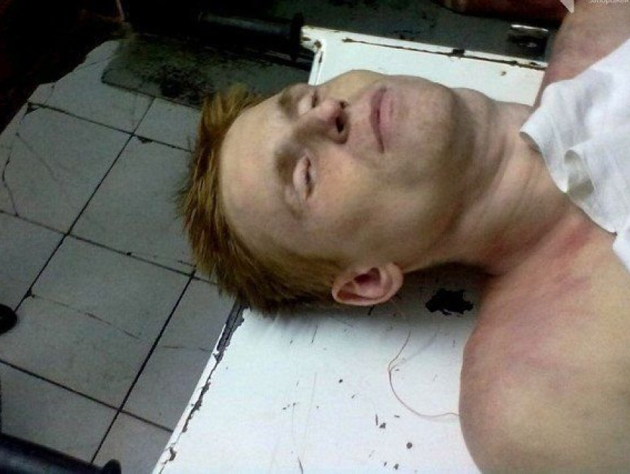 В Запорожье на теле погибшего после допроса парня были синяки