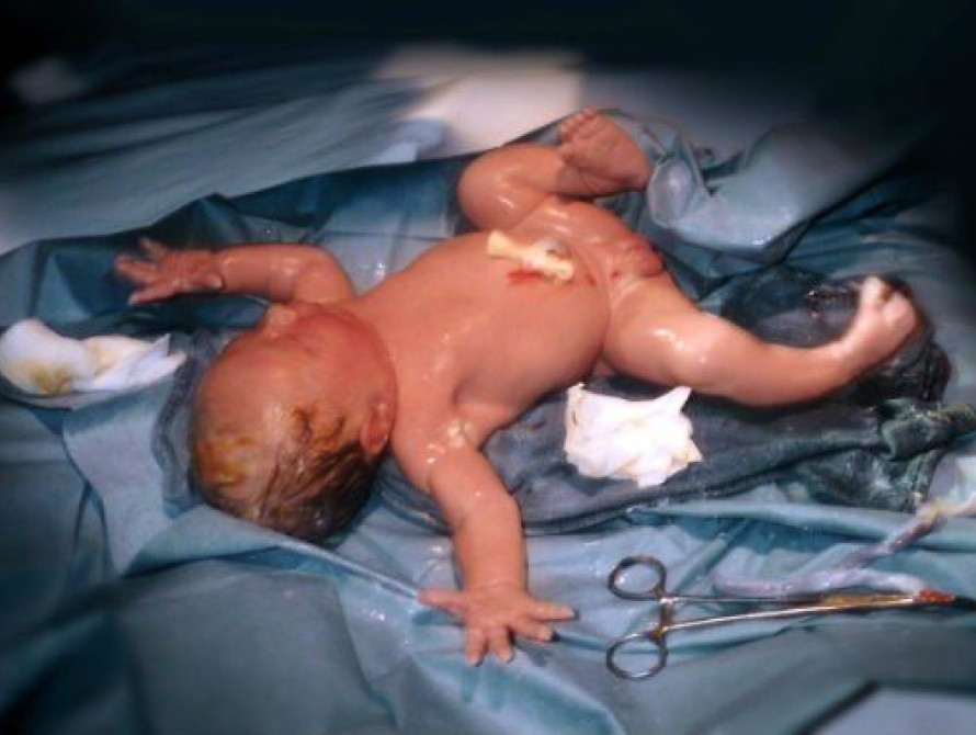 В Запорожье у беженцев родился ребенок