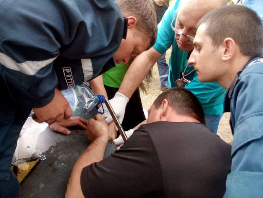 Запорожские спасатели вызволяли 13-летнюю девушку, которая засунула палец в дырку