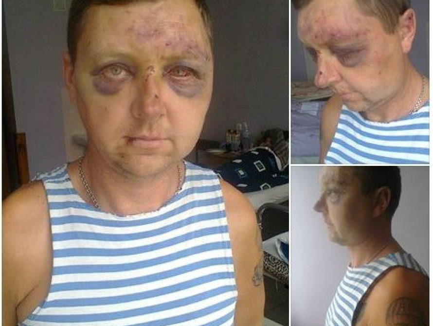 В Запорожье активисты задержали мужчину, избившего бойца АТО