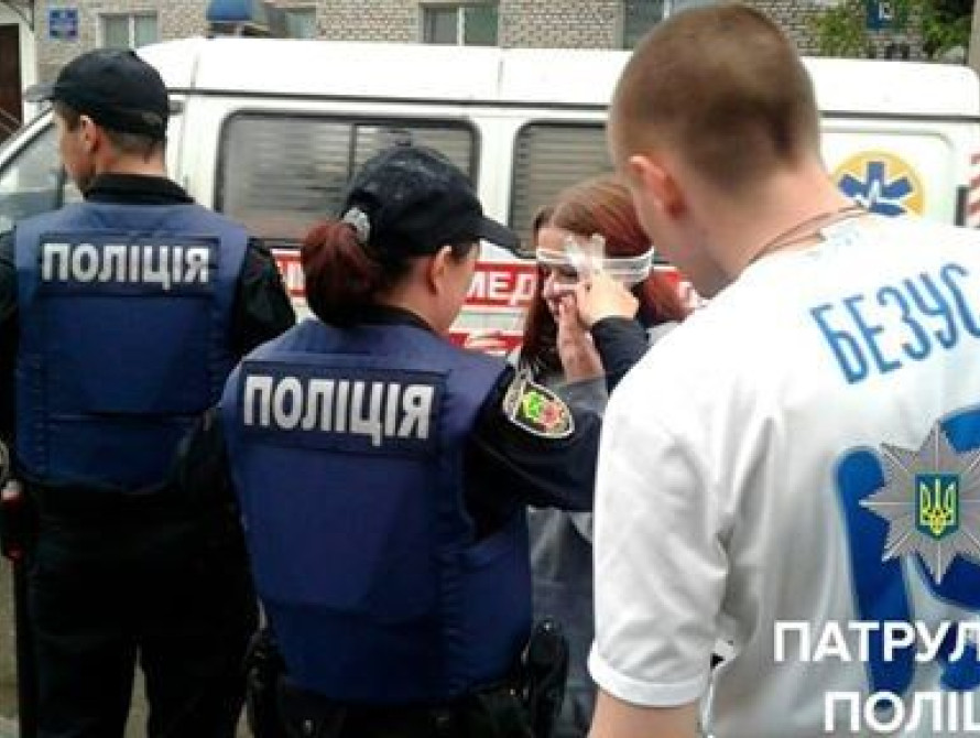 Девушка, которой разбили голову на запорожском стадионе - фанатка "Днепра"